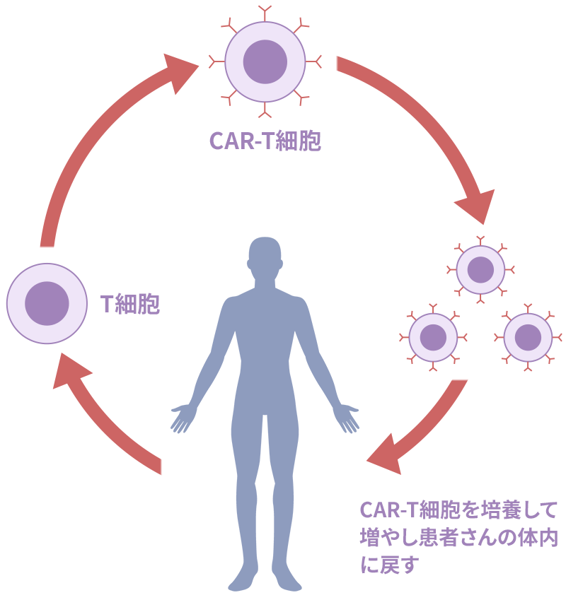 CAR-T療法